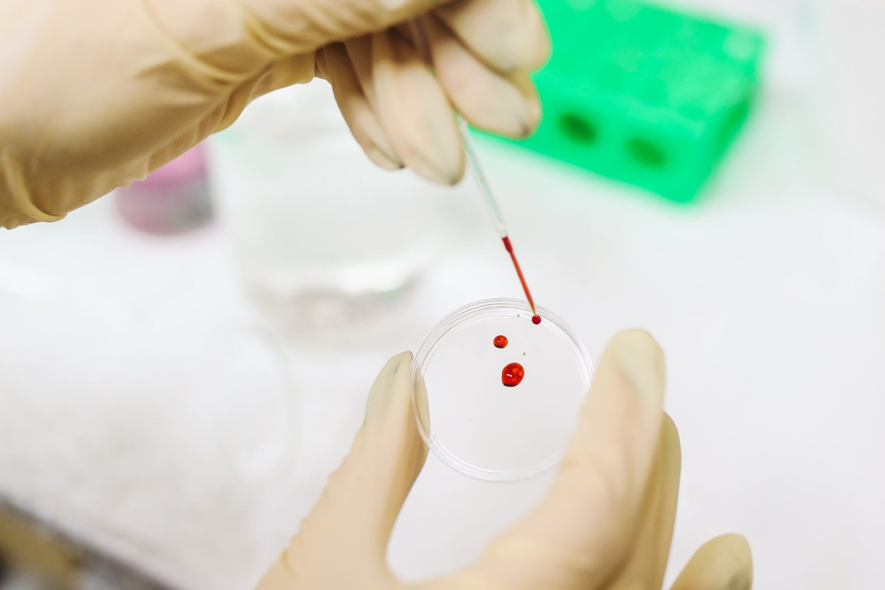 A gloved hand releasing a drop of blood into a small dish with a pipette